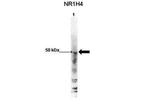 FXR Antibody in Western Blot (WB)