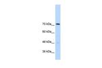 GTF2IRD1 Antibody in Western Blot (WB)