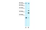 KIF3B Antibody in Western Blot (WB)