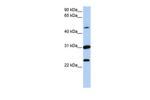 XK Antibody in Western Blot (WB)