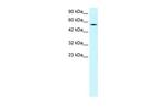 PNLIP Antibody in Western Blot (WB)