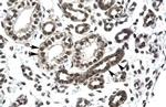 PTHLH Antibody in Immunohistochemistry (Paraffin) (IHC (P))