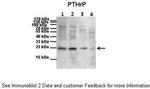 PTHLH Antibody in Western Blot (WB)