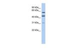 ZNF179 Antibody in Western Blot (WB)