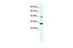 PREB Antibody in Western Blot (WB)