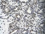 SMARCB1 Antibody in Immunohistochemistry (Paraffin) (IHC (P))