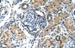 TIMELESS Antibody in Immunohistochemistry (IHC)