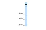 TIMELESS Antibody in Western Blot (WB)