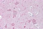 EGR3 Antibody in Immunohistochemistry (IHC)