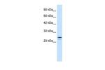 RNF2 Antibody in Western Blot (WB)