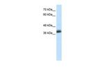 SAP30BP Antibody in Western Blot (WB)