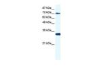 CNOT3 Antibody in Western Blot (WB)