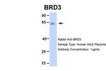 BRD3 Antibody in Western Blot (WB)