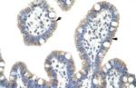 IkB beta Antibody in Immunohistochemistry (IHC)