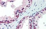 NRF1 Antibody in Immunohistochemistry (Paraffin) (IHC (P))