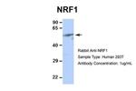 NRF1 Antibody in Western Blot (WB)