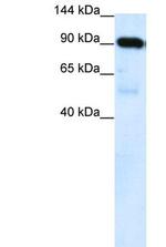 SUV420H1 Antibody in Western Blot (WB)