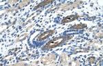 NACC2 Antibody in Immunohistochemistry (IHC)