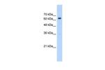 NACC2 Antibody in Western Blot (WB)