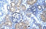 TRIM15 Antibody in Immunohistochemistry (IHC)