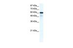 GABRA1 Antibody in Western Blot (WB)