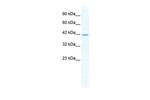 GABRA3 Antibody in Western Blot (WB)