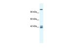 NMDAR2C Antibody in Western Blot (WB)