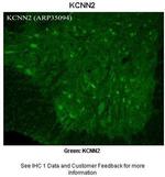 KCNN2 Antibody in Immunohistochemistry (IHC)
