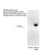 KCNN3 Antibody in Western Blot (WB)