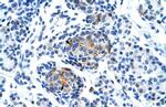 P2X1 Antibody in Immunohistochemistry (IHC)