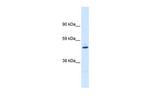 KVbeta1 (KCNAB1) Antibody in Western Blot (WB)