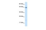 ASIC3 Antibody in Western Blot (WB)