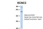 KV3.3 (KCNC3) Antibody in Western Blot (WB)