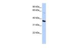 KV1.8 (KCNA10) Antibody in Western Blot (WB)