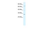 KCNIP1 Antibody in Western Blot (WB)