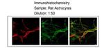 MLC1 Antibody in Immunohistochemistry (IHC)