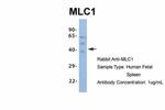 MLC1 Antibody in Western Blot (WB)