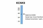 KCNK9 Antibody in Western Blot (WB)