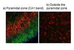 TRPV4 Antibody in Immunohistochemistry (IHC)