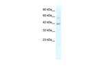 KCTD10 Antibody in Western Blot (WB)