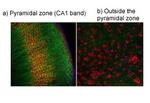 TRPV4 Antibody in Immunohistochemistry (IHC)