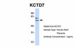 KCTD7 Antibody in Western Blot (WB)