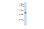 KCTD7 Antibody in Western Blot (WB)