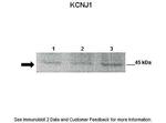 Kir1.1 (KCNJ1) Antibody in Western Blot (WB)