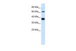 GluR6 Antibody in Western Blot (WB)