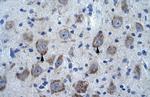 KCTD13 Antibody in Immunohistochemistry (IHC)