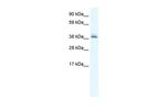 KCTD13 Antibody in Western Blot (WB)