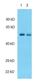 GABRG2 Antibody in Western Blot (WB)