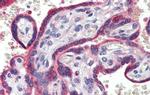 ZNF165 Antibody in Immunohistochemistry (IHC)