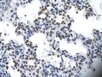 ILF2 Antibody in Immunohistochemistry (Paraffin) (IHC (P))